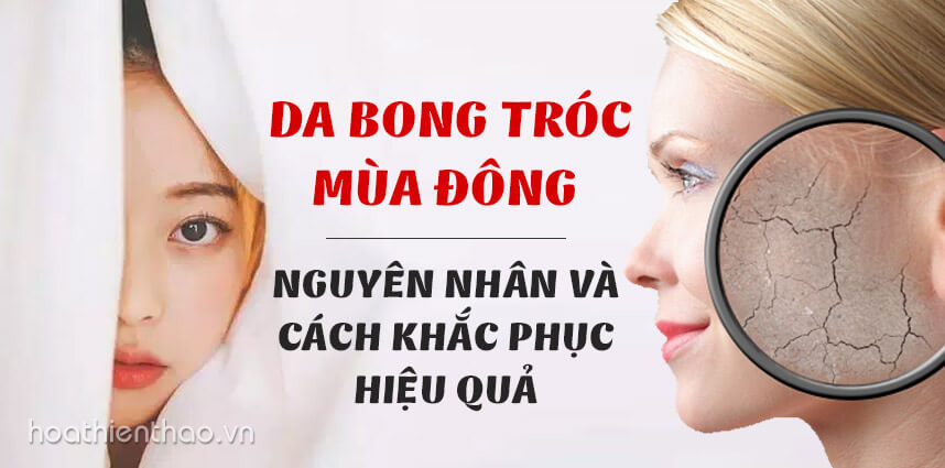Da bong tróc mùa đông Nguyên nhân và cách khắc phục - Hoa Thien Thao Cosmetics