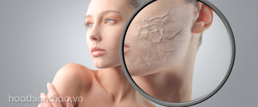 Da khô thiếu nước - HoaThienThao