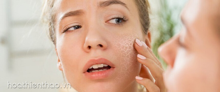 Da khô thiếu nước - HoaThienThao