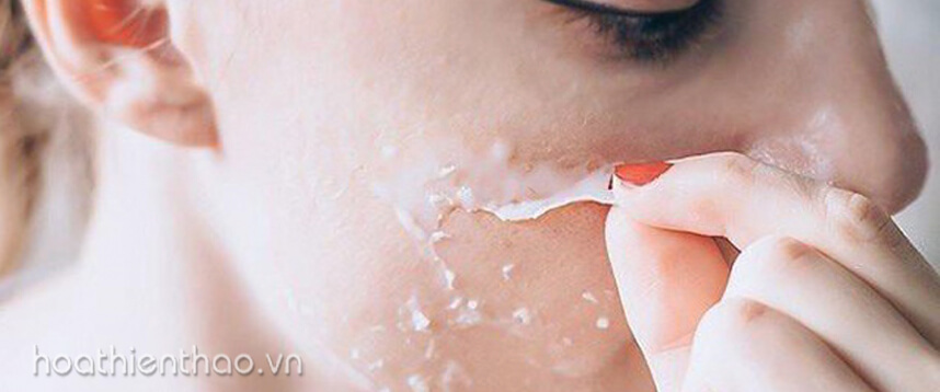 Da khô thiếu nước - HoaThienThao