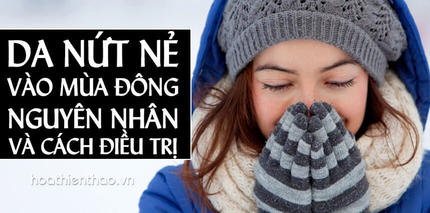 Da nứt nẻ vào mùa đông - Hoa Thien Thao Cosmetics