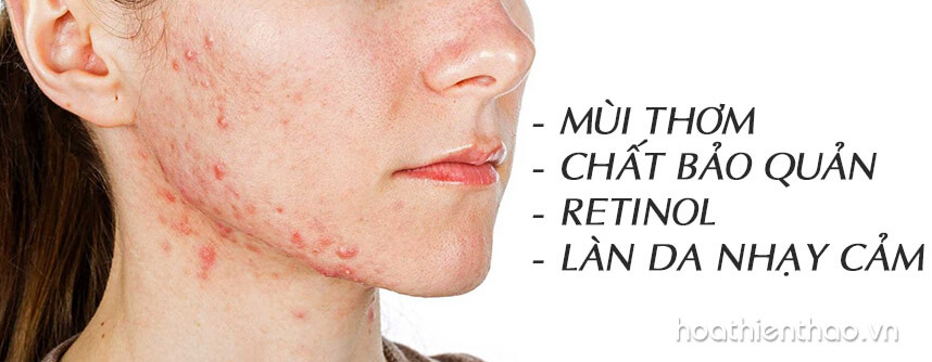 Dị ứng mỹ phẩm nguyên nhân và cách điều trị - Hoa Thien Thao Cosmetics