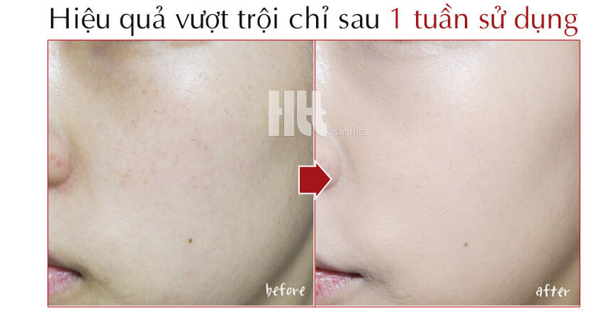 có nên bôi kem dưỡng da vào ban đêm - Hoa Thiên Thảo