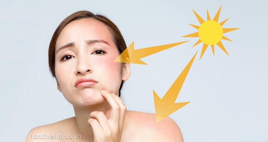 Kem dưỡng trắng da mặt không ăn nắng - HoaThienThao