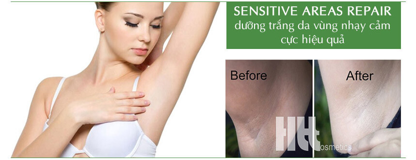 Kem dưỡng trắng da vùng nhạy cảm Bella Belle giá bao nhiêu - Hoa Thiên Thảo