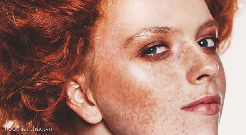 Kem trị nám tàn nhang của Nhật - HoaThienThao