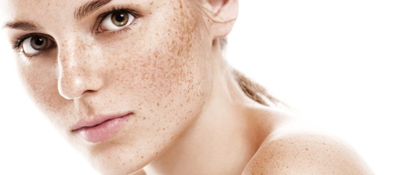 Không thể coi thường những vấn đề của da khi bạn 25 tuổi - hoathienthaovn