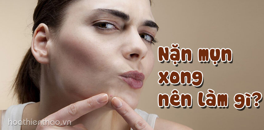 Mới nặn mụn xong nên làm gì để không đỏ và thâm - Hoa Thiên Thảo