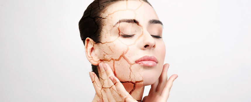 Nguyên nhân và giải pháp chống lão hóa da tuổi 30 - Hoa Thien Thao