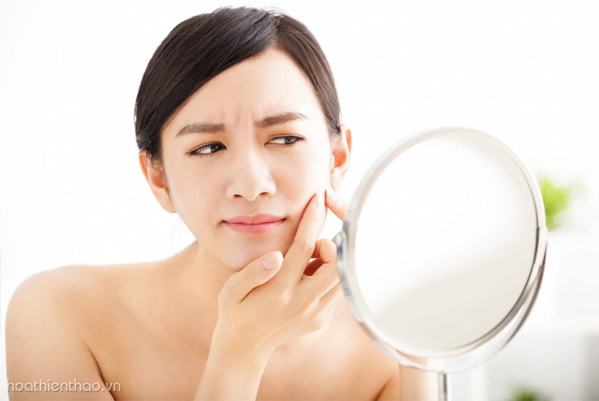 Do những vết sẹo cũ không được điều trị dứt điểm