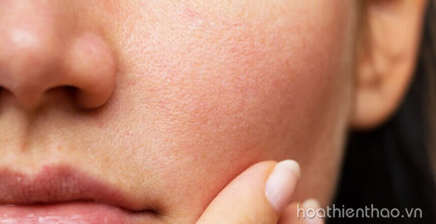 Phục hồi da hư tổn bằng cách nào - HoaThienThao