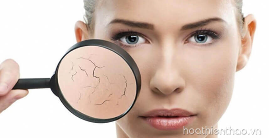 Phục hồi da hư tổn bằng cách nào - HoaThienThao