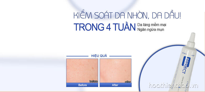 Review kem kiểm soát nhờn Perfect chi tiết - Hoa Thiên Thảo