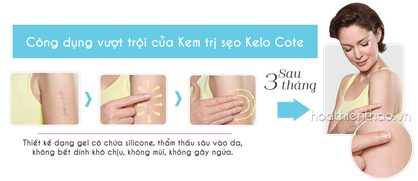 Review kem trị sẹo Kelo Cote chi tiết cho bạn gái - Hoa Thiên Thảo