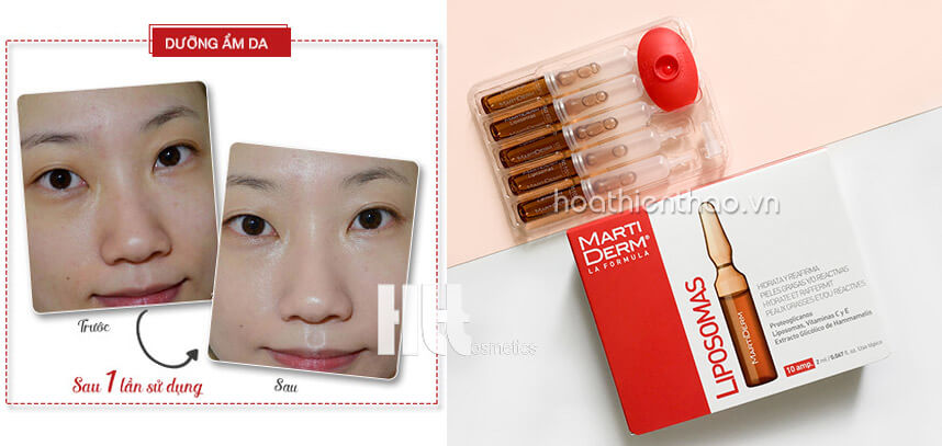 Review serum dưỡng ẩm MartiDerm chi tiết từng dòng sản phẩm - hoathienthaovn