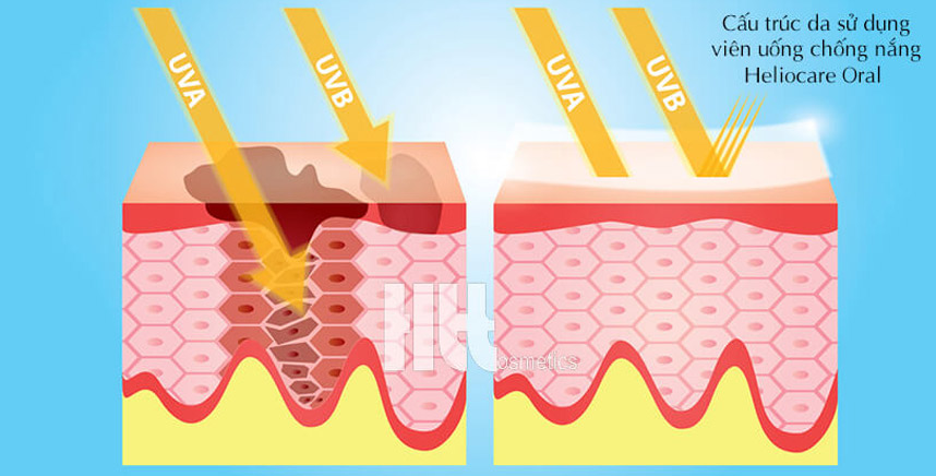 Review viên uống chống nắng Heliocare - Hoa Thiên Thảo