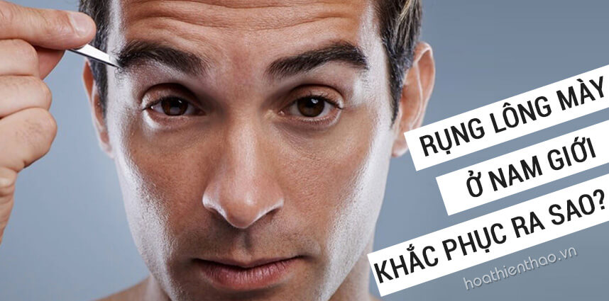 Rụng lông mày ở nam giới khắc phục ra sao - HoaThienThao