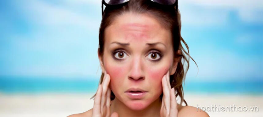 Sản phẩm chăm sóc da sau lăn kim HOT - HoaThienThao