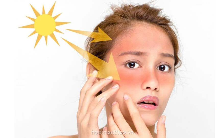 Serum dưỡng trắng cho da nhạy cảm - HoaThienThao