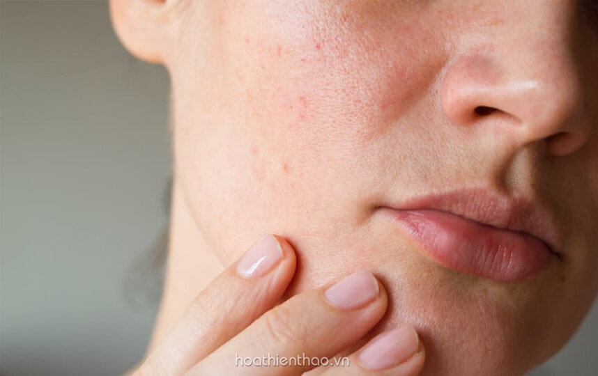 Serum dưỡng trắng cho da nhạy cảm - HoaThienThao