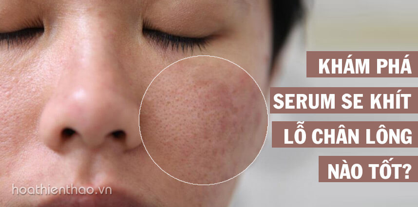 Serum se khít lỗ chân lông nào tốt - Hoa Thiên Thảo