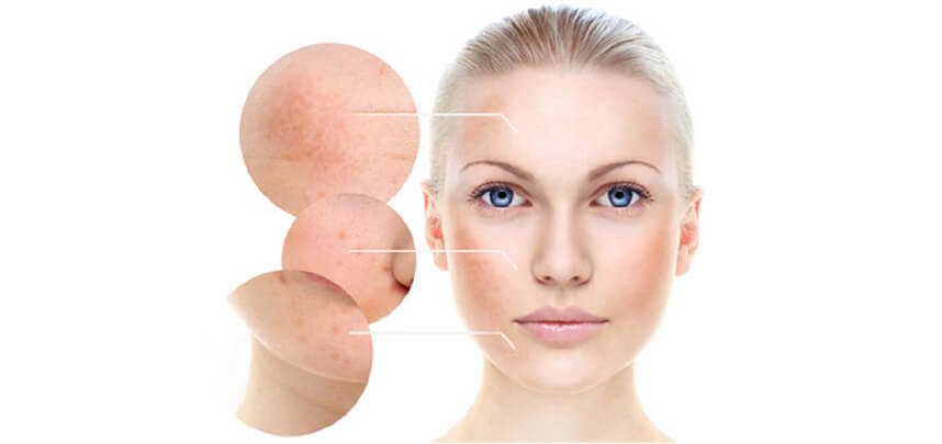 Serum trị nám Murad có tốt không? HoaThienThao