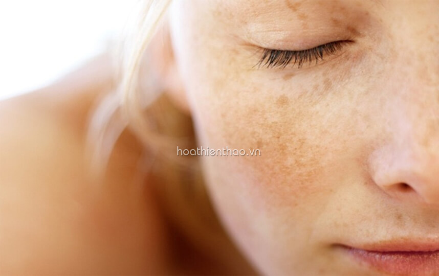 So sánh viên uống trị nám Perfect White và Murad - HoaThienThao