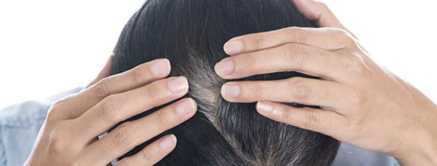 rau diếp cá và mật ong - Hoa Thiên Thảo