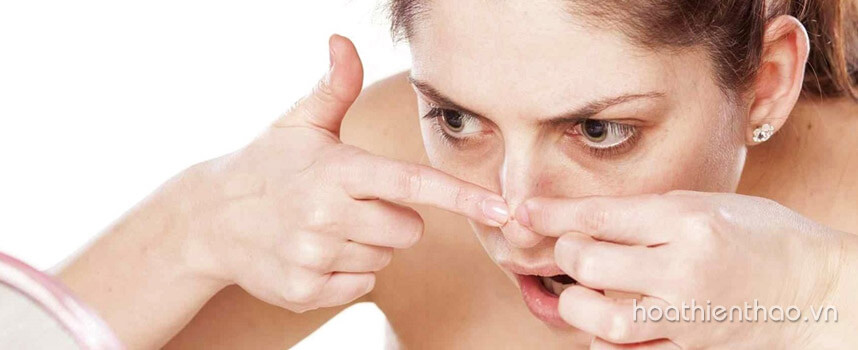 Bạn có biết tại sao trị mụn hoài không hết - Hoa Thiên Thảo