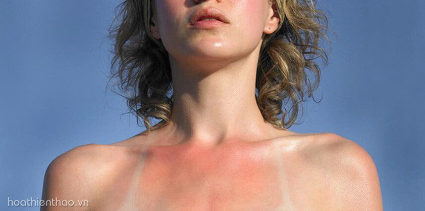 Viên uống chống nắng đi biển - HoaThienThao