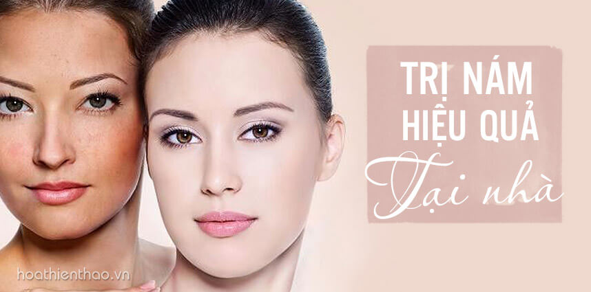 Các phương pháp trị nám hiệu quả tại nhà từ thiên nhiên cho chị em