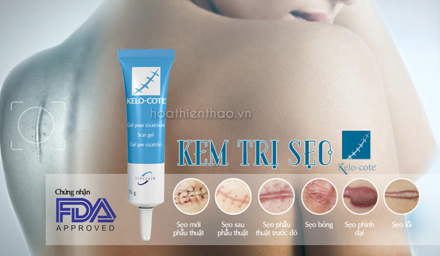 Kem Kelo-Cote có trị được sẹo lồi không