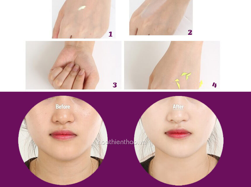 Phương pháp trị nám hiệu quả từ thiên nhiên vô cùng an toàn
