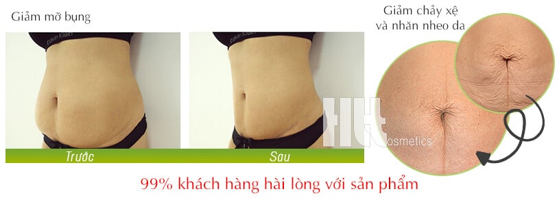 Kem massage tan mỡ bụng Jada Gold Shape Lotion - Hoa Thiên Thảo