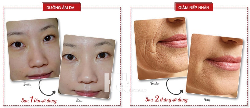 Serum dưỡng ẩm chống lão hóa MartiDerm cho da dầu - Hoa Thiên Thảo