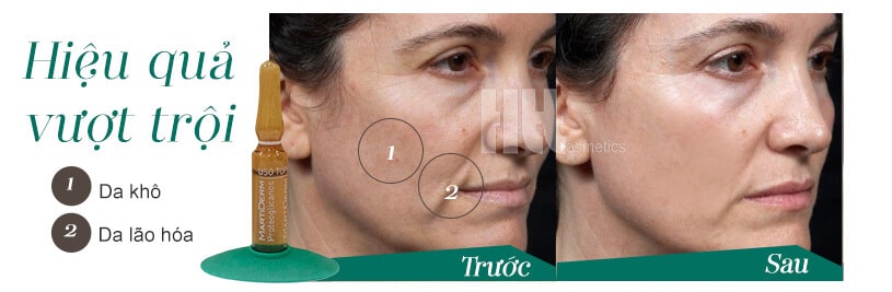 Serum dưỡng ẩm chống lão hóa MartiDerm cho da khô - Hoa Thiên Thảo