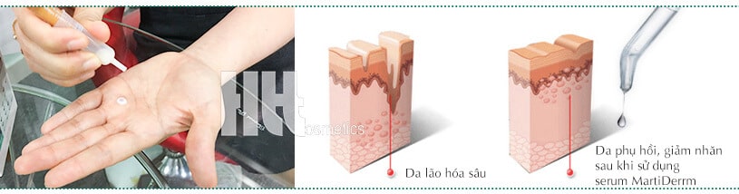 Serum dưỡng ẩm chống lão hóa MartiDerm cho da khô - Hoa Thiên Thảo
