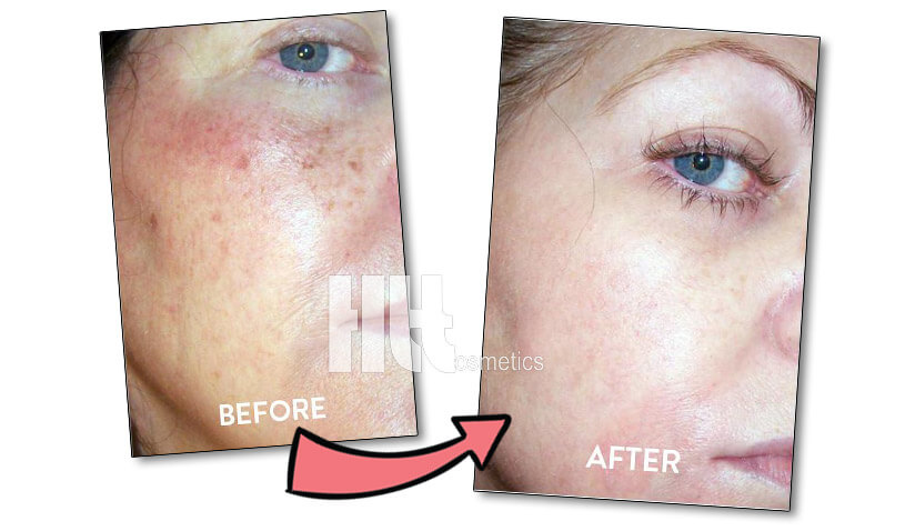 Serum trắng da giảm nám iS Clinical C-15 Advance+ - Hoa Thiên Thảo