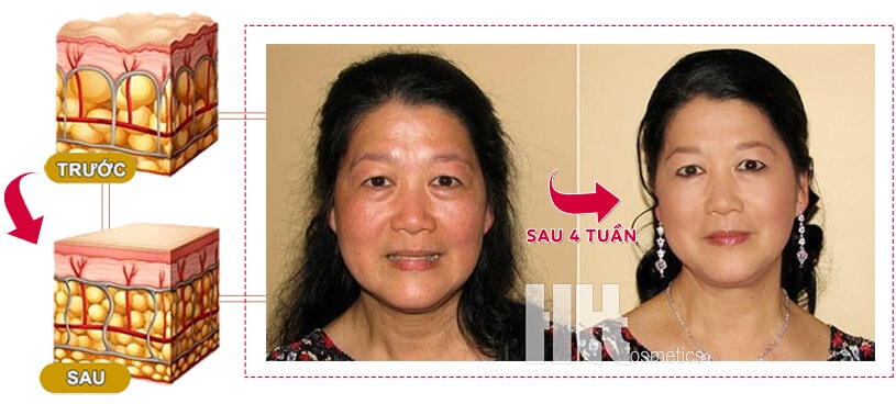 Tinh chất nhau thai cừu A&Plus A016 - Hoa Thiên Thảo