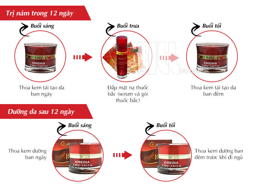 Bộ kem trị nám Nhật Bản cao cấp Kireina - Mỹ Phẩm Chính Hãng Hoa Thiên Thảo