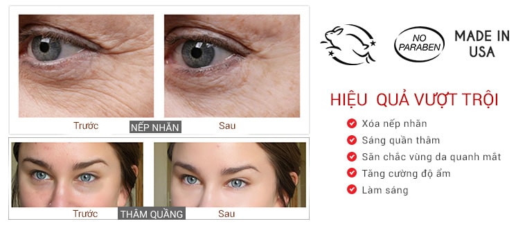 Bộ serum trẻ hóa da, giảm quầng thâm, xóa nhăn da vùng mắt Medpeel Vitamin C 30x