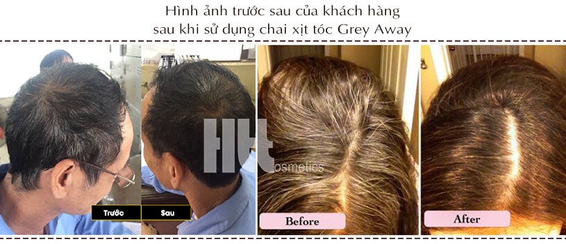 Chai xịt giảm tóc bạc Grey Away Med Eq Gaiapharma - Hoa Thiên Thảo