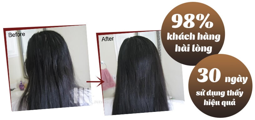 dầu gội mọc tóc của mỹ - Hoa Thiên Thảo
