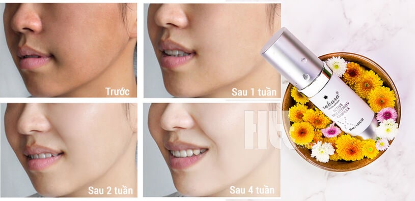 Enzyme trị nám trắng da Sakura Active Brightening Complex - Hoa Thien Thao Cosmetics