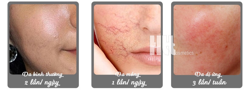 Enzyme trị nám trắng da Sakura Active Brightening Complex - Hoa Thien Thao Cosmetics