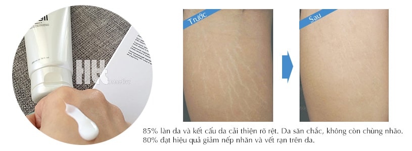 Serum trị rạn da săn chắc toàn thân Mesoestetic Stem Cell Body