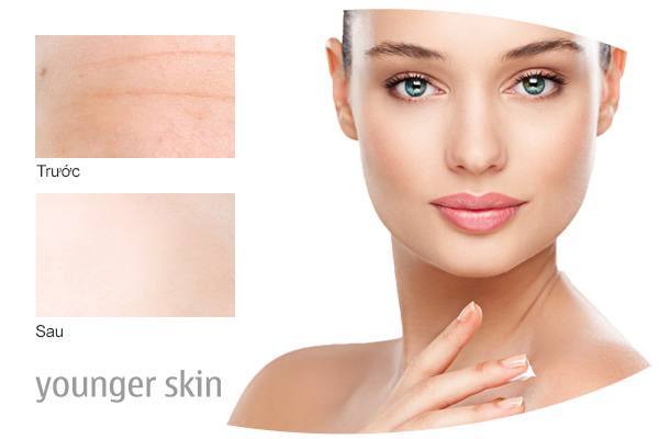 Kem giảm lão hóa da ban đêm Mesoestetic Radiance DNA