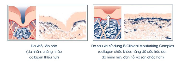 Kem dưỡng ẩm iS Clinical Moisturizing Complex