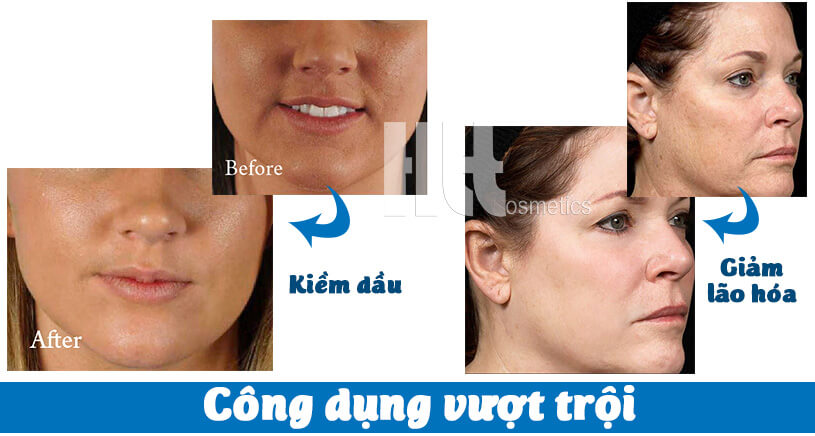 Kem dưỡng chống nắng cho da dầu da lão hóa Murad Moisturizer SPF30 PA - Hoa Thiên Thảo