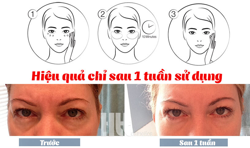 Kem dưỡng da mắt chuyên sâu Murad Eye Lift Firming Treatment - Hoa Thiên Thảo